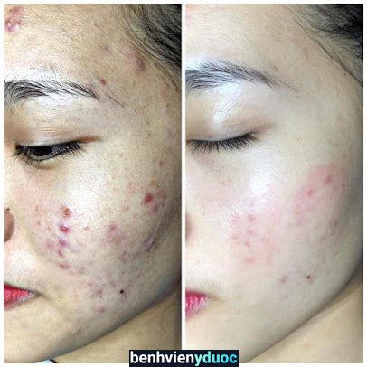 Nhi Beauty Spa - Chăm sóc điều trị da chuyên sâu 8 Hồ Chí Minh