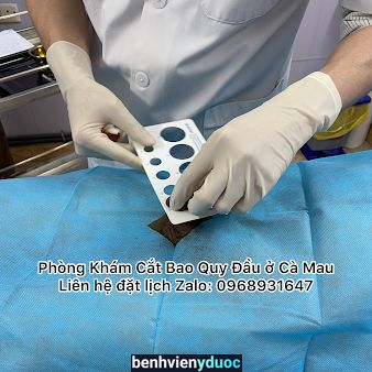 Phòng Khám Cắt Bao Quy Đầu ở Cà Mau Cà Mau Cà Mau