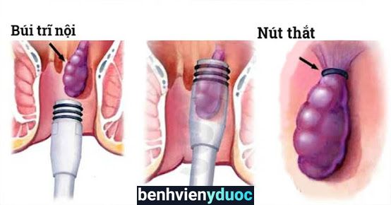 Phòng khám chuyên khoa ngoại Bác sĩ Nguyễn Tiến Lực Thủ Dầu Một Bình Dương