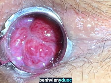 Phòng khám chuyên khoa ngoại Bác sĩ Nguyễn Tiến Lực Thủ Dầu Một Bình Dương