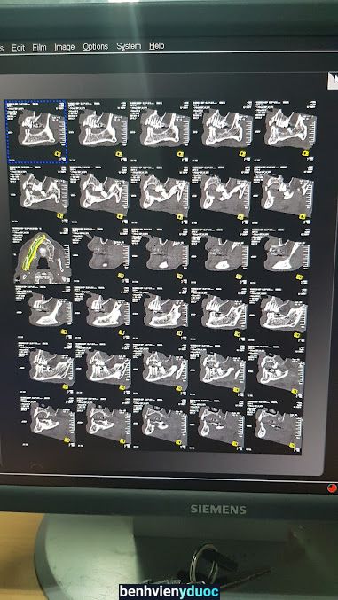 Phòng Khám Đa Khoa 38 Lê Lợi Quy Nhơn Bình Định