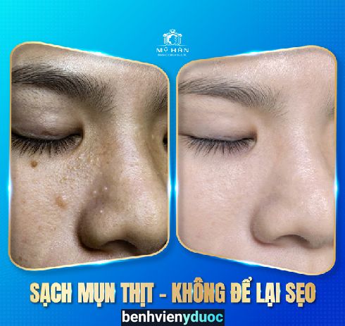 Phòng Khám Da Liễu MỸ HÀN