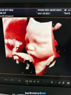 Phòng Khám Ông Ngọc Siêu Âm Vinh Nghệ An