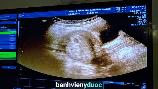 Phòng Khám Phụ Sản Hồng Ngọc Hà Tĩnh Hà Tĩnh