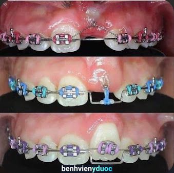 Phòng Khám Răng Bs An Quỳnh Lưu Nghệ An