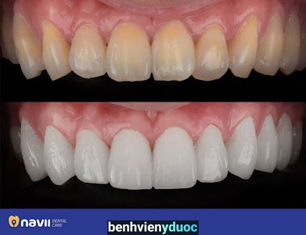 Phòng Khám Răng - Hàm - Mặt Bs Hải Định Quán Đồng Nai