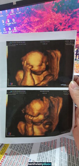 Phòng Khám Sản Phụ Khoa An Sinh Hoằng Hóa Thanh Hóa
