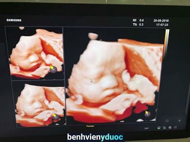 Phòng Khám Sản Phụ Khoa Bs An - Bs Hải Huế Thừa Thiên Huế