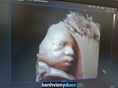 Phòng khám siêu âm 5D - BSCKI Phan Văn Phước Phù Cát Bình Định