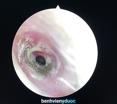 Phòng Khám Tai Mũi Họng - Bs Minh Trang Vũng Tàu Bà Rịa - Vũng Tàu
