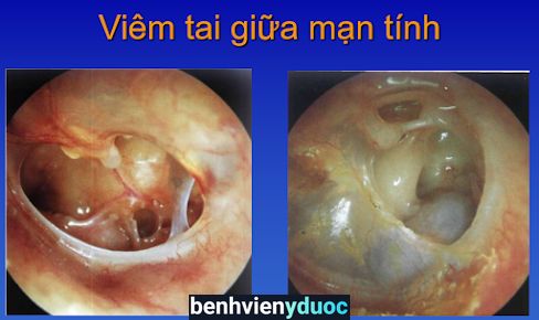 Phòng Khám Tai Mũi Họng BS. Nguyễn Anh Quỳnh Thuận Thành Bắc Ninh