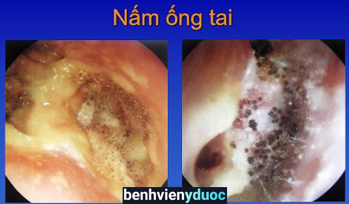 Phòng Khám Tai Mũi Họng BS. Nguyễn Anh Quỳnh Thuận Thành Bắc Ninh