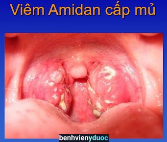 Phòng Khám Tai Mũi Họng BS. Nguyễn Anh Quỳnh Thuận Thành Bắc Ninh
