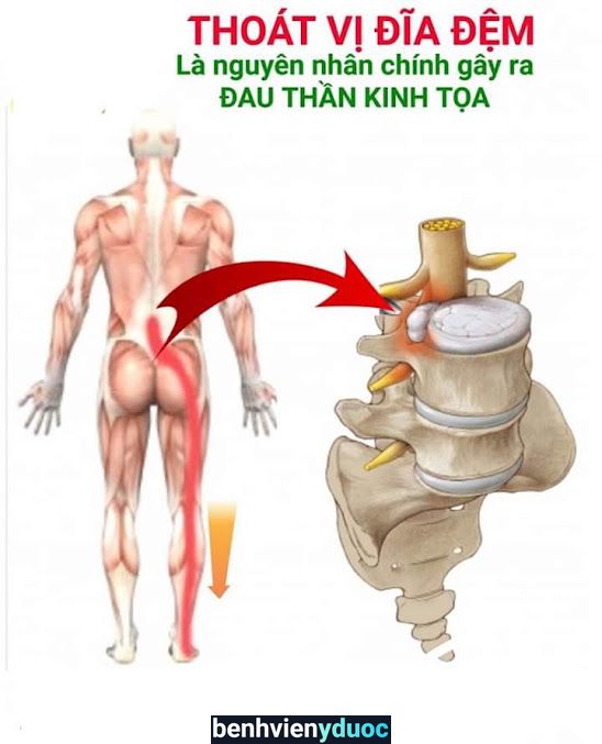 Phòng Khám Vật Lý Trị liệu Hữu Phước Hóc Môn Hồ Chí Minh