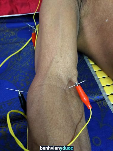 Phòng khám Y Học Dân Tộc Huyền Linh Đường Gò Vấp Hồ Chí Minh