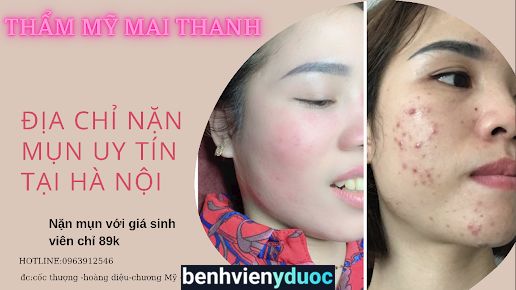 Phun Xăm Thẩm Mỹ - Mai Thanh - Beauty Spa Chương Mỹ Hà Nội