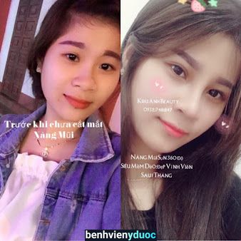 Phun Xăm Viện Thẩm Mỹ Kiểu Anh Biên Hòa Đồng Nai