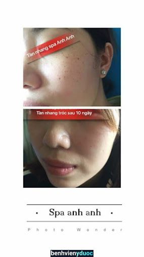 spa anh anh Hóc Môn Hồ Chí Minh