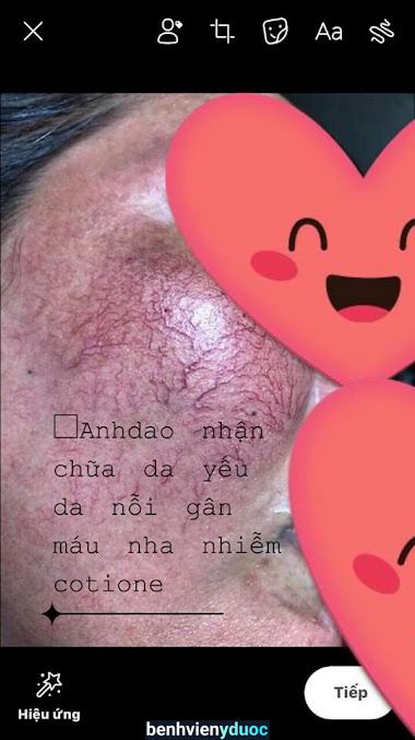 SPA ANHDAO ( tận tâm - uy tín - công nghệ cao) Bình Chánh Hồ Chí Minh