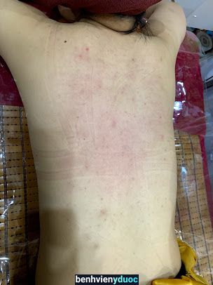 Spa Huyền Anh (Cơ Sở 1) Hà Đông Hà Nội