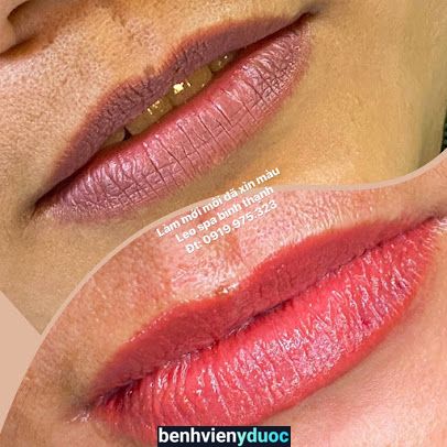 SPA LEO: TRỊ NÁM_TÀN NHANG_MAO MẠCH_MỤN_ĐIÊU KHẮC HIFU_GIẢM BÉO_TÓC. Bình Thạnh Hồ Chí Minh