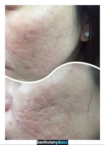 Spa Minh Thư Tân Bình Hồ Chí Minh