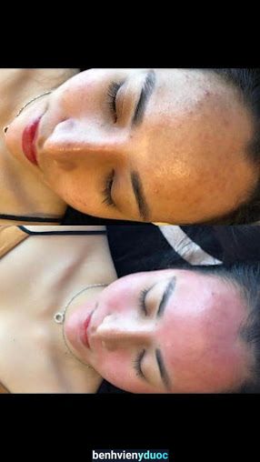 Spa quận 5 Been spa 5 Hồ Chí Minh