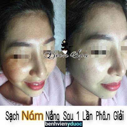 Spa quận 5 Been spa 5 Hồ Chí Minh