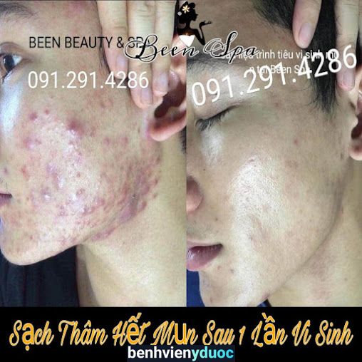 Spa quận 5 Been spa 5 Hồ Chí Minh