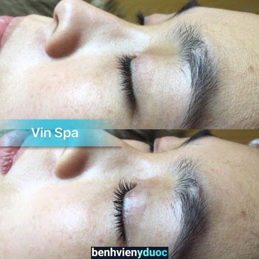 Spa Vin Đà Lạt Lâm Đồng