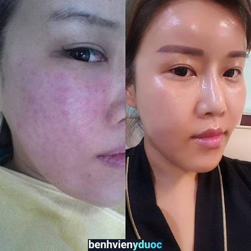 SPA WABI SABI Đan Phượng Hà Nội