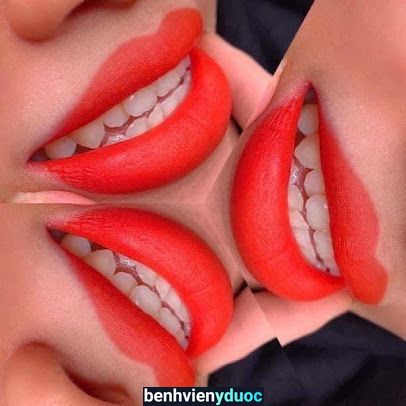 Thẩm Mỹ Hải Yến Vĩnh Yên Vĩnh Phúc