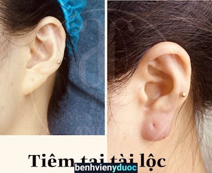 Thẩm mỹ Hk Hai Bà Trưng Hà Nội