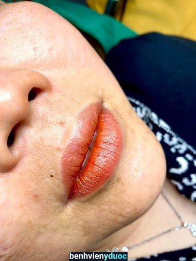 Thẩm Mỹ Lệ Thu Cao Lãnh