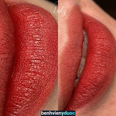 Thẩm mỹ viện Lady Beauty & Academy 6 Hồ Chí Minh