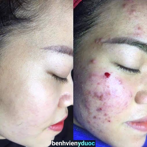 Thu Hiền Spa Thủ Đức Hồ Chí Minh