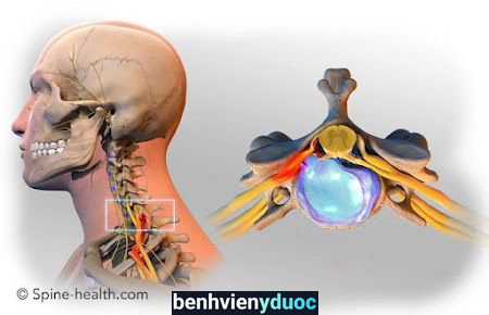 TRỊ LIỆU THẦN KINH CỘT SỐNG NGUYỄN HOÀNG HẢI LONG Hóc Môn Hồ Chí Minh