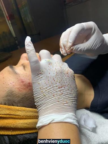 Trung Tâm SPA Trị Mụn Trị Nám Huynh Thảo Hóc Môn Hồ Chí Minh