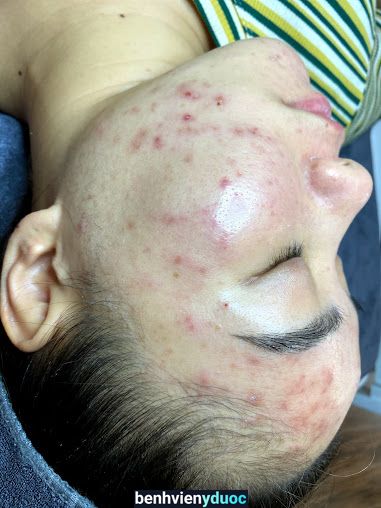 Tuyết Nguyễn Spa - Dĩ An Dĩ An Bình Dương