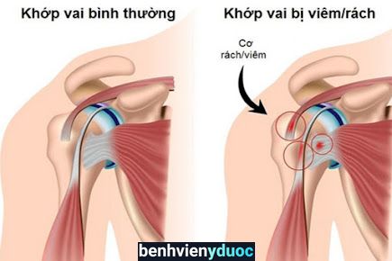 VẬT LÝ TRỊ LIỆU CHIROPRACTIC (PK LÊ HUY) Vị Thanh Hậu Giang