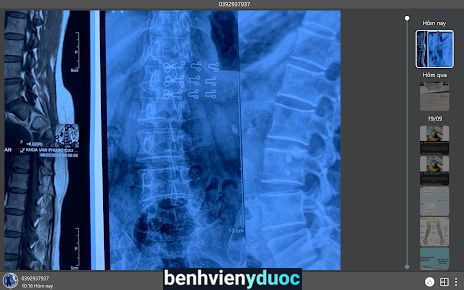 VẬT LÝ TRỊ LIỆU CHIROPRACTIC (PK LÊ HUY) Vị Thanh Hậu Giang