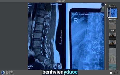 VẬT LÝ TRỊ LIỆU CHIROPRACTIC (PK LÊ HUY) Vị Thanh Hậu Giang