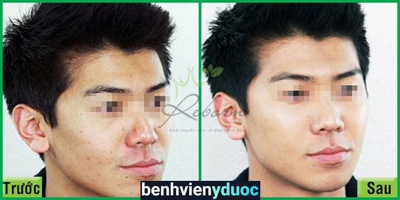 Viện REBORN - Số 1 Trị Liệu Da Liễu Ba Đình Hà Nội