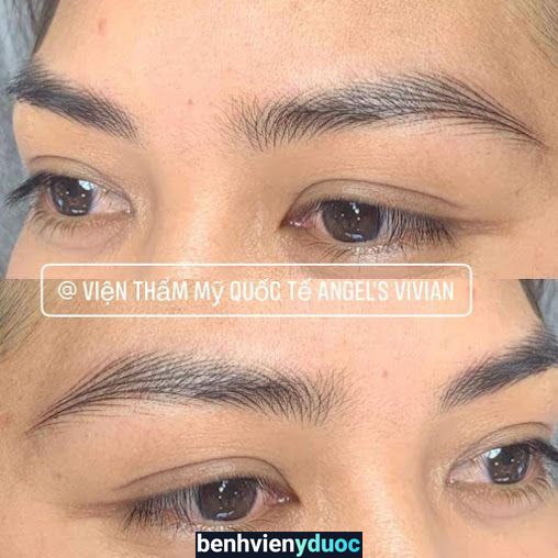 Viện Thẩm Mỹ Angel's Vivian (Thẩm mỹ toàn diện) Cà Mau Cà Mau