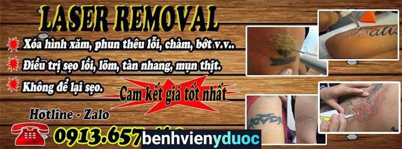 Xóa xăm Bình Dương Thuận An Bình Dương